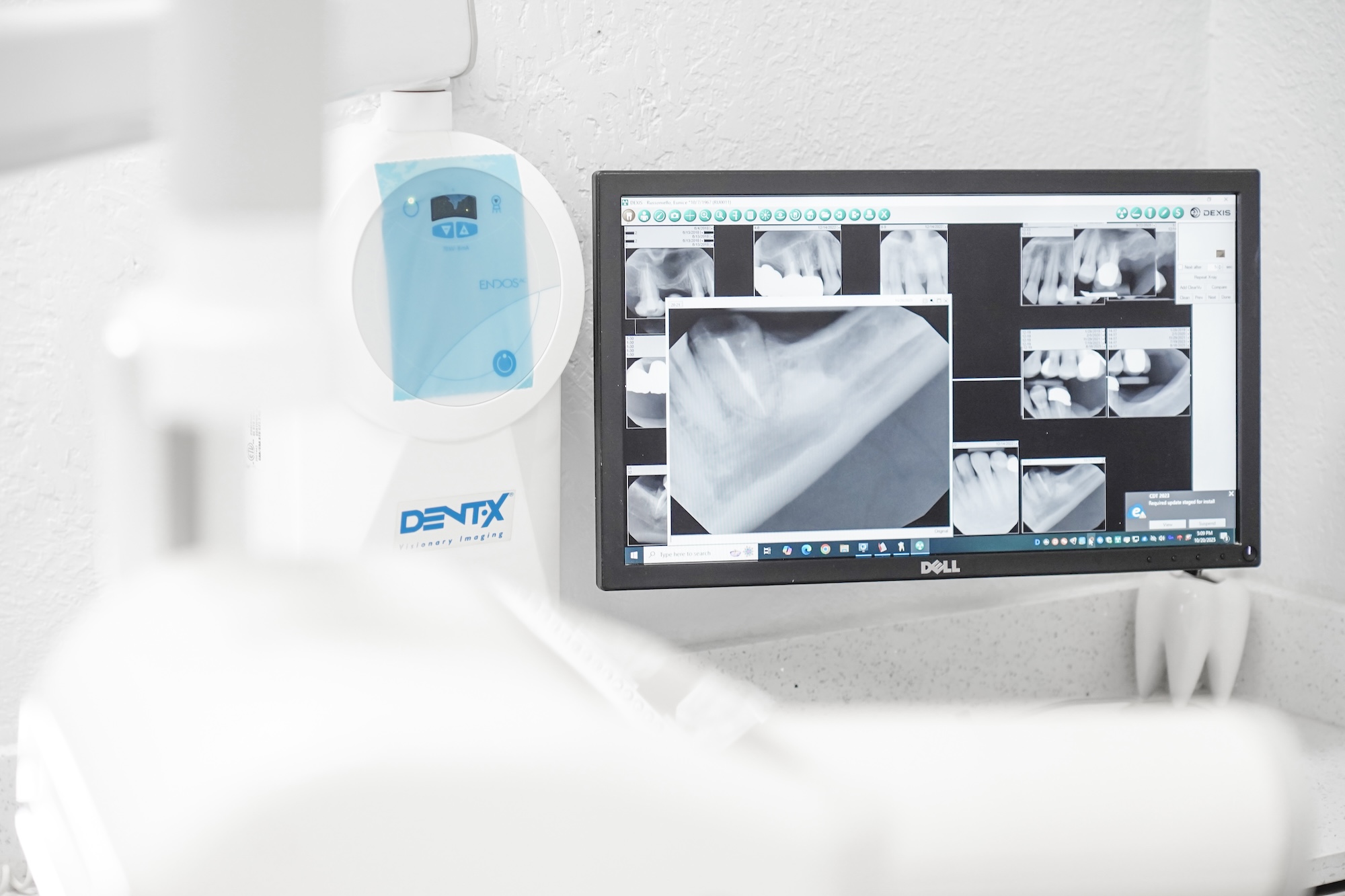 Comprehensive Family Dentistry | Cosmetic Dentistry, Sedation Dentistry and Veneers